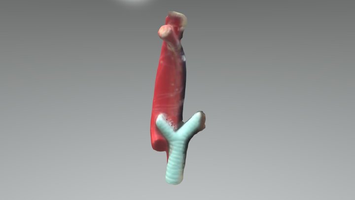 Artery and Trachea 3D Model