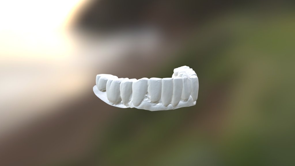 Ken Lower Jaw
