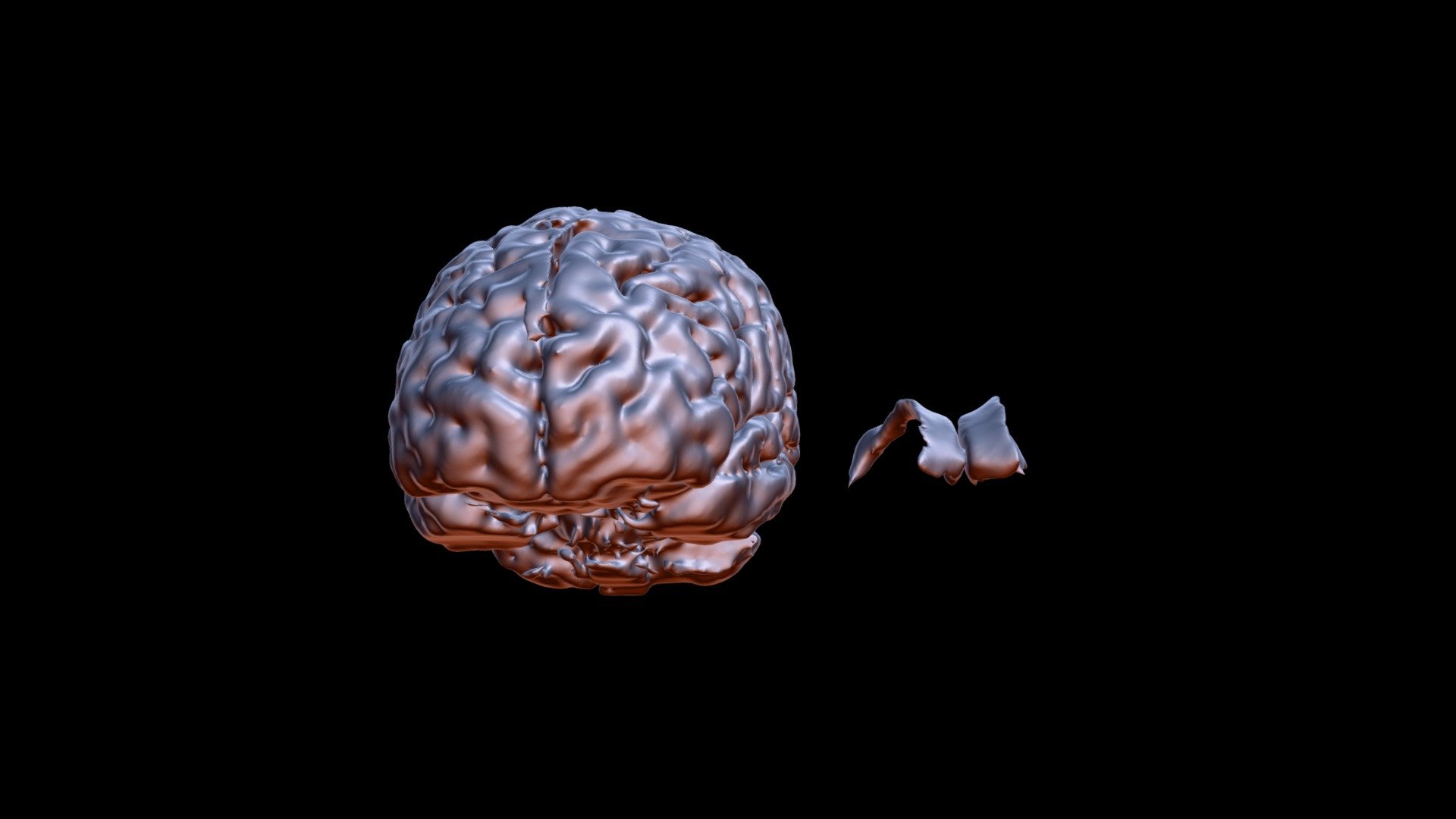 Young Brain and Lateral Ventricles