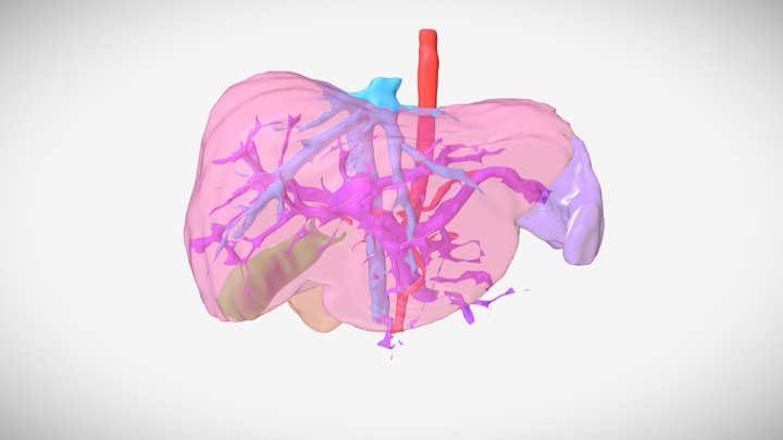 Post-op liver anatomy with segment 6/7 resected 3D Model