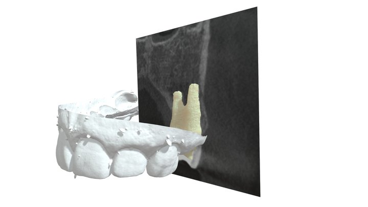 BionicTooth 3D-Viewer 3D Model