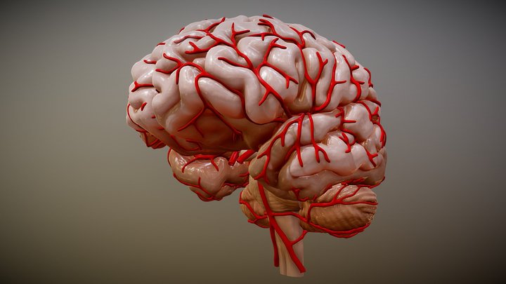 Brain example1 3D Model