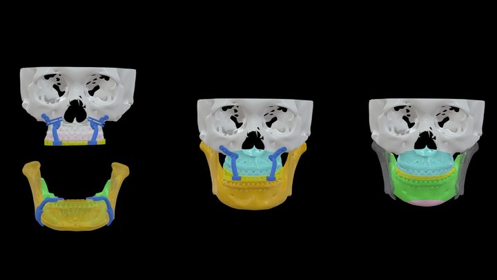 Dr.許-蔡O娟-0130 3D Model