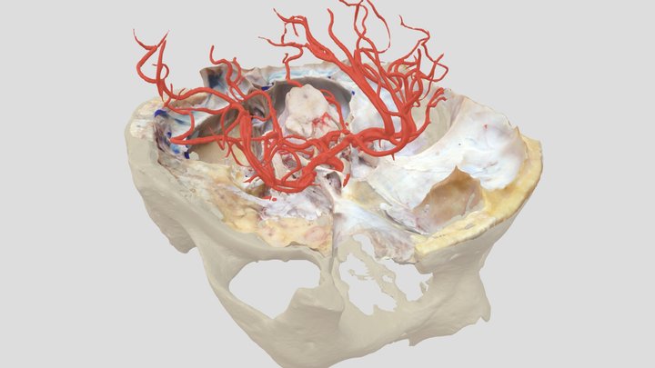 Skullbase Brainstem skull and arteries 3D Model