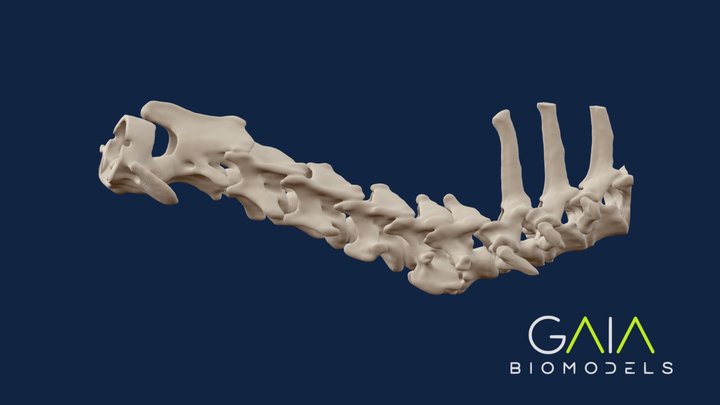 Intervertebral disc disease (IVDD) DOG 3D Model