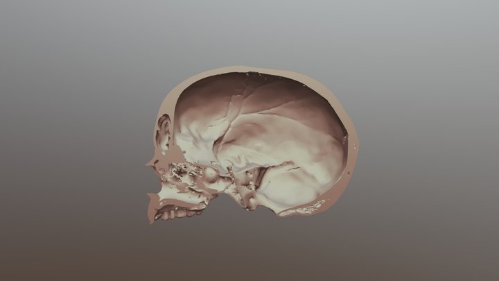Human Half Skull 3D Model