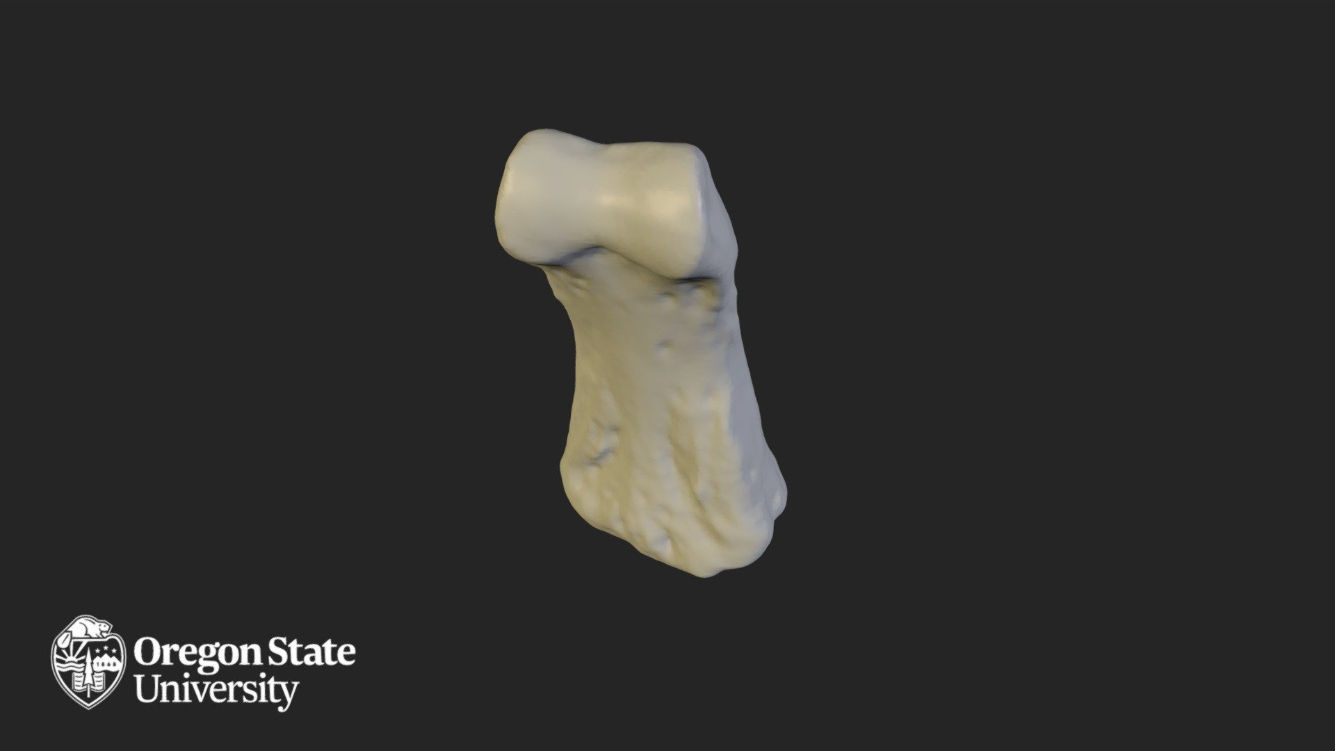Intermediate Phalange 3
