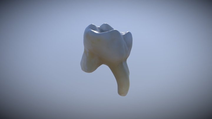 UD4 Tooth 3D Model
