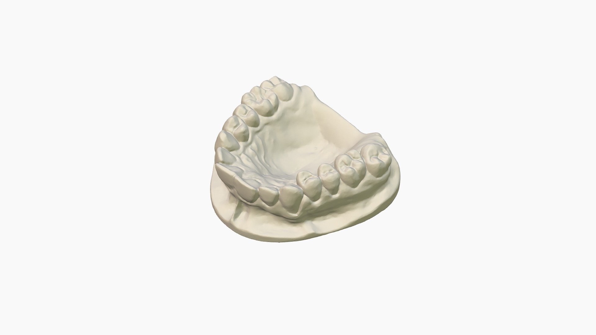 Dental 3D Scan - 3D model by vger3D [e745e3d] - Sketchfab