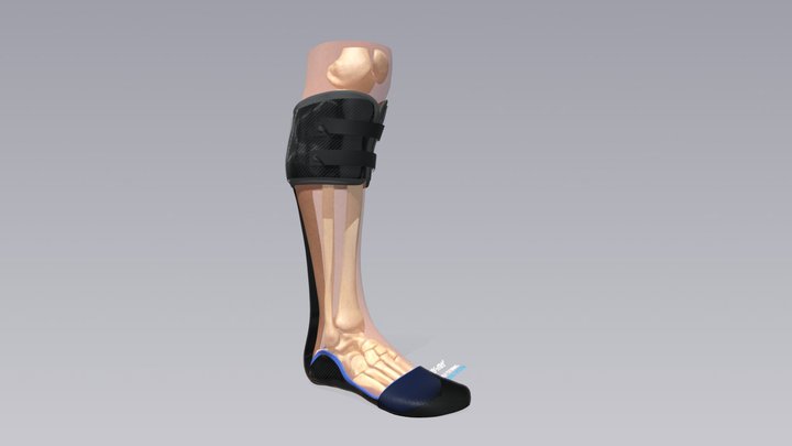 Trans-Met 3D Model