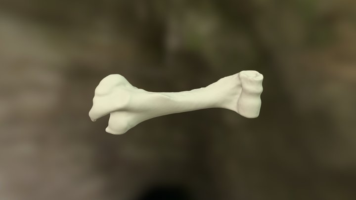 Humerus reconstruction 3D Model