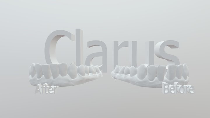 Clarus Clear Aligners Dental 3d Models 3D Model
