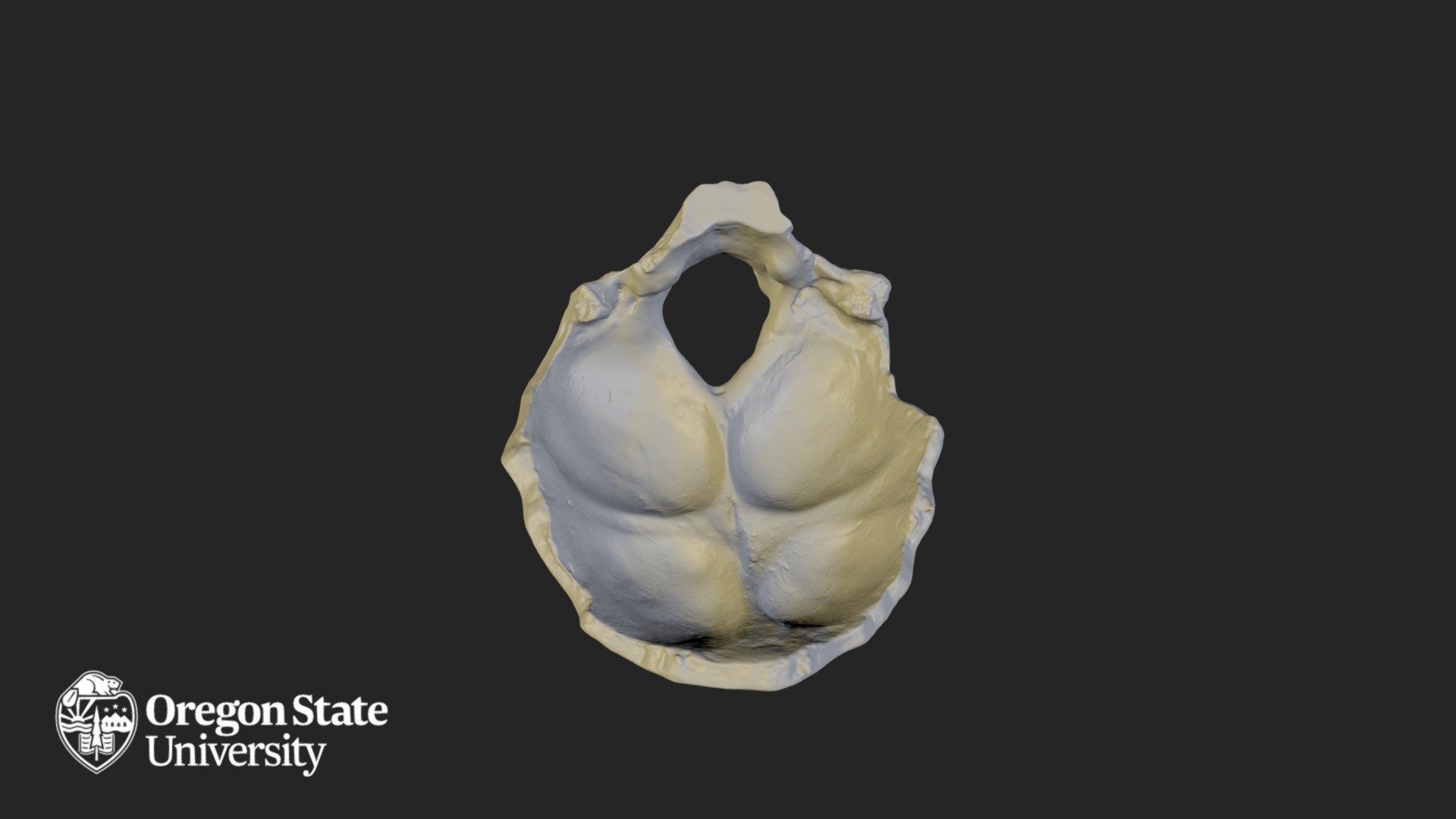 Occipital