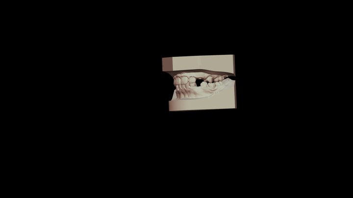 2017.04.26 initial 3D Model