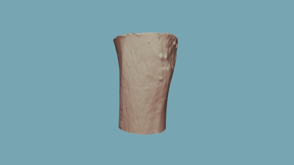 4-3 (Post-burn)