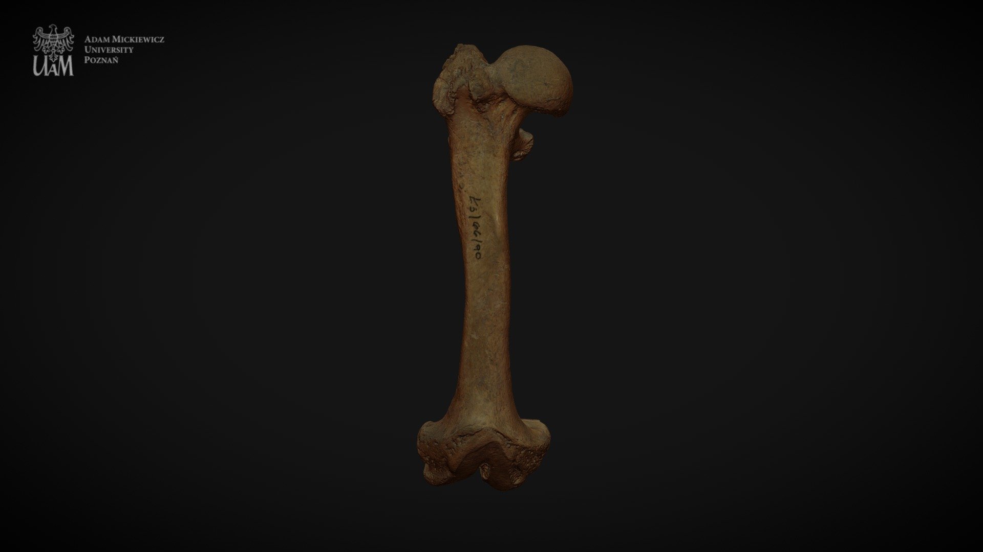 Achondroplastic dwarf - right femur - 3D model by AMU Human ...