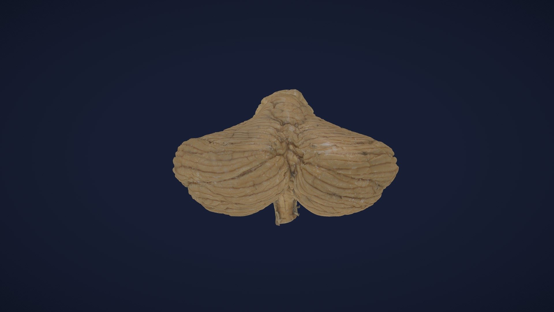 Cerebellum 2 - 3D model by AnatomieRostock [e8a34a6] - Sketchfab