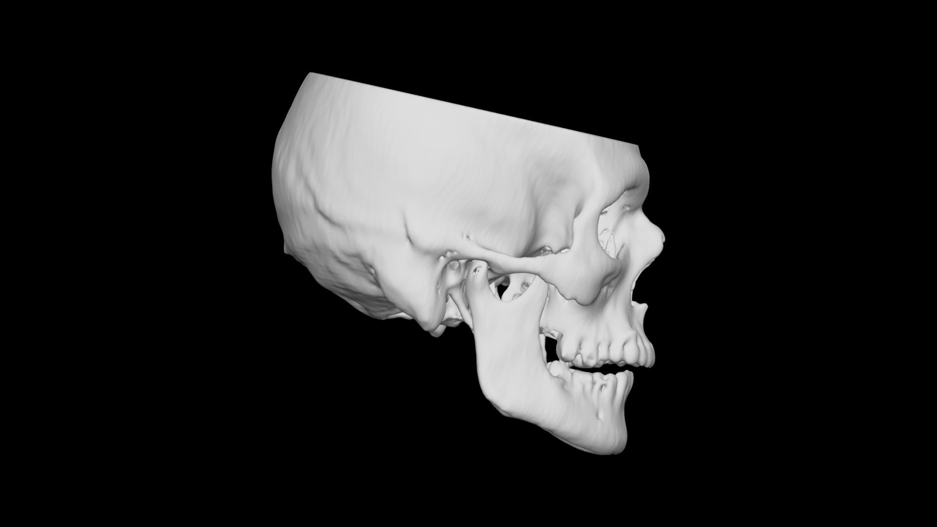 Skull Male 45yo