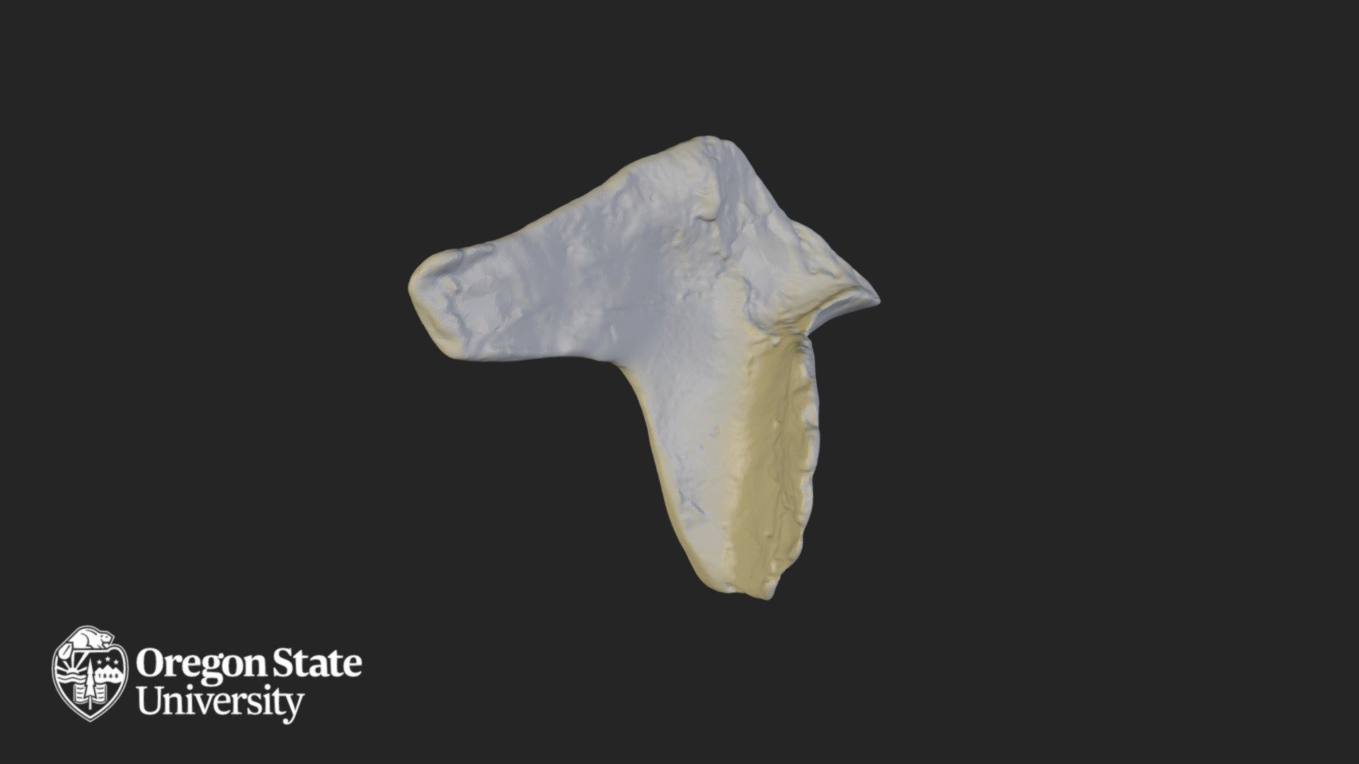Zygomatic Right