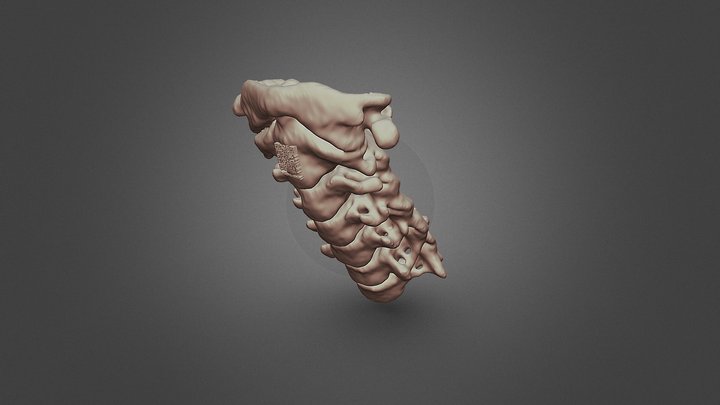 Cervical Rachis Biomodel by CT Scan 3D Model