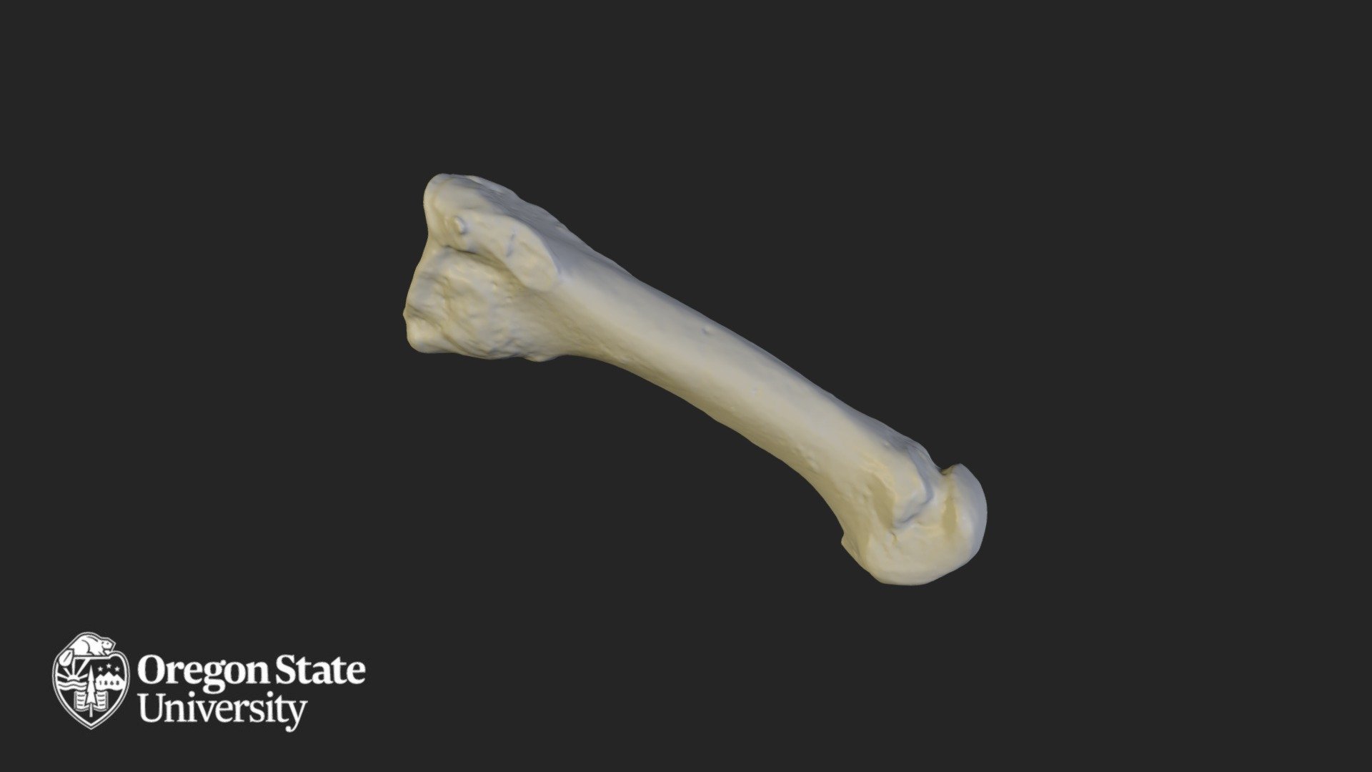 Metatarsal 2