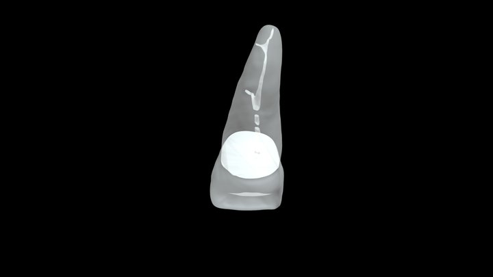 9 Calcified 3D Model