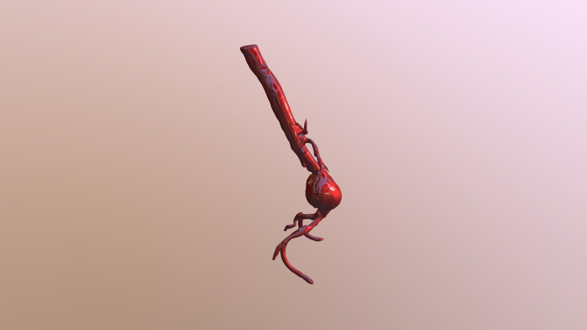 abdominal aortic aneurysm