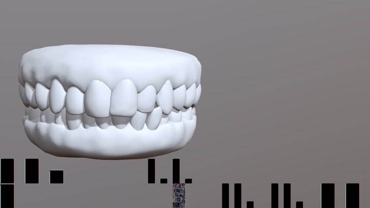 Teeth Movement Crowding Central Change New 3D Model