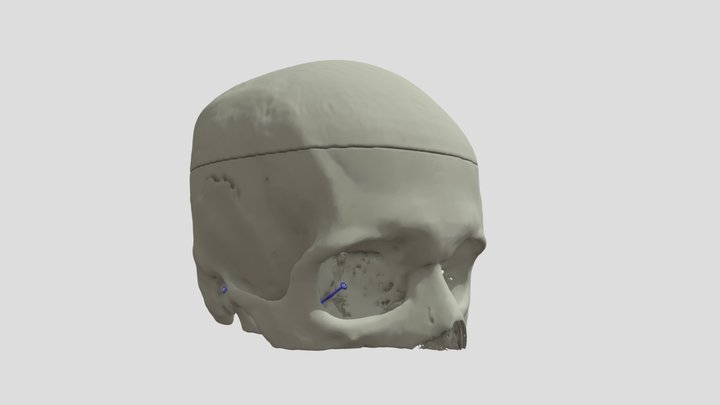 Forámenes Craneales – Modello 3D gratuito STL