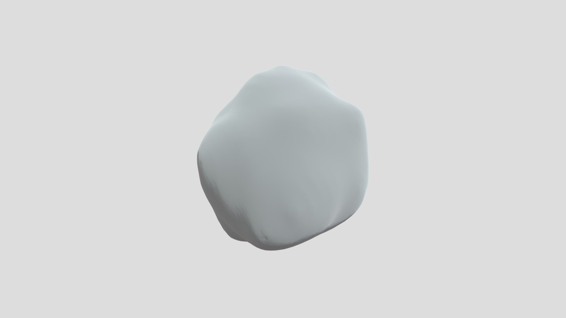 Tumor — Sketchfab embed 3D viewer
