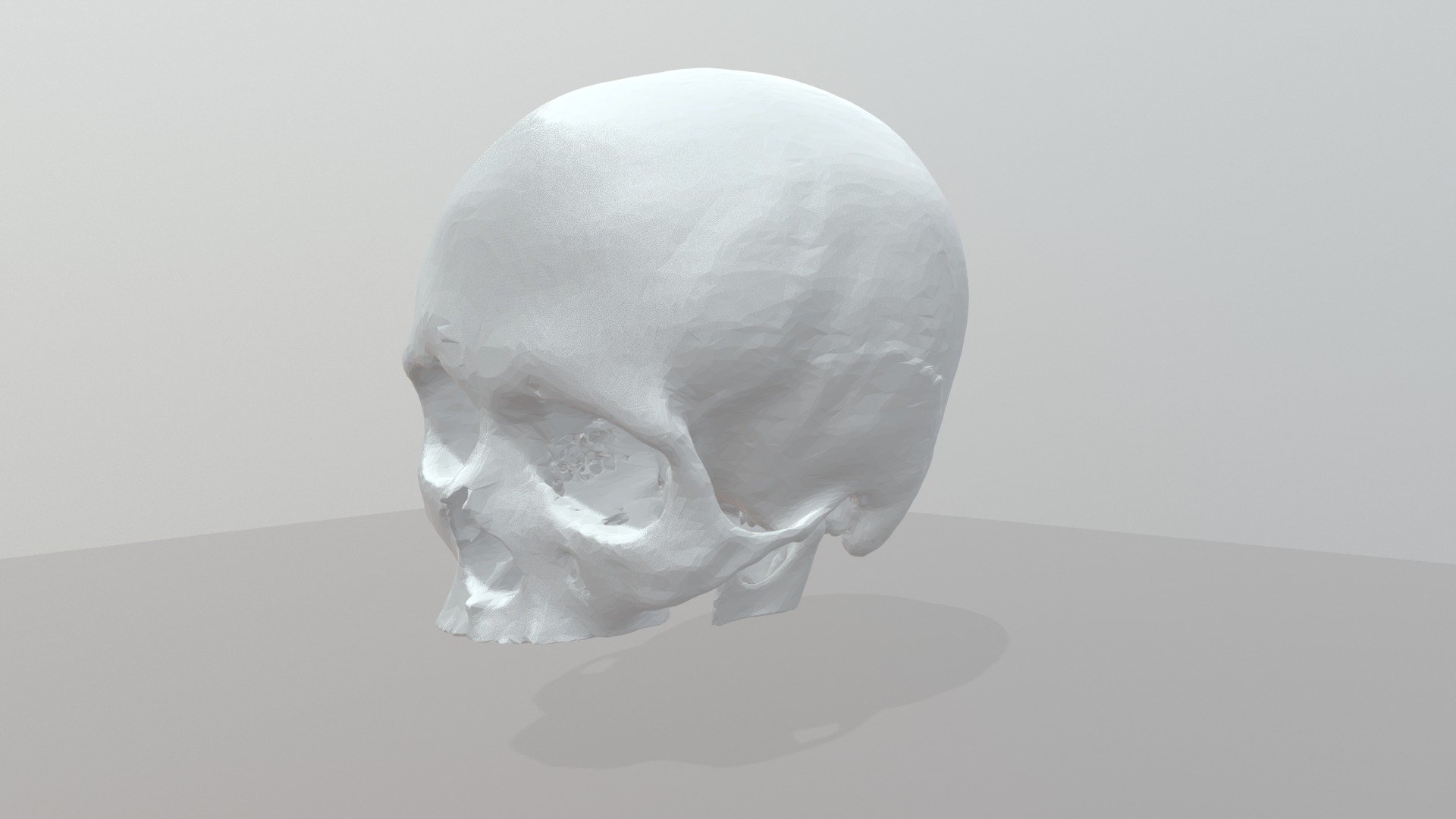 CT Scan Skull