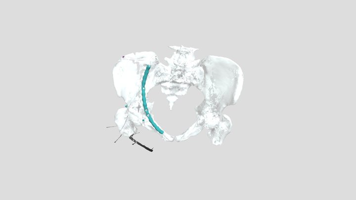 Schweigert Pelvix 3D Model