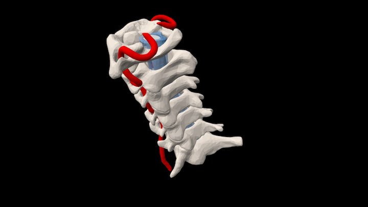 Cervical 3D Model