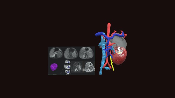 194R_328F_66L_Radiology 3D Model
