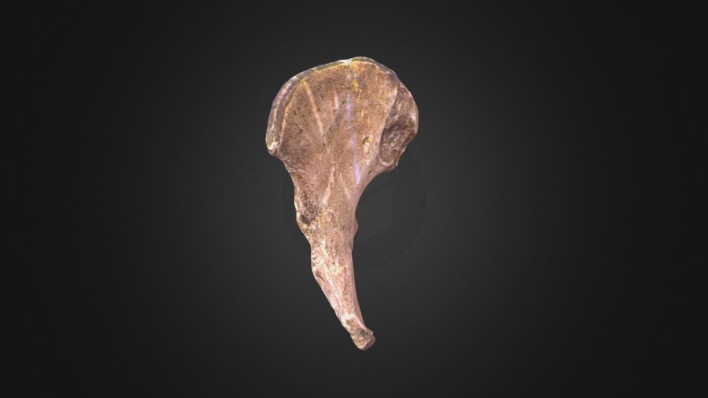 Pygmy pelvis