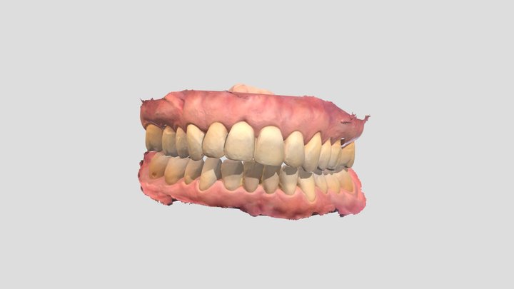 KCs