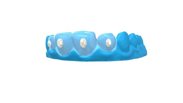 Orthodontics 3D models - Sketchfab