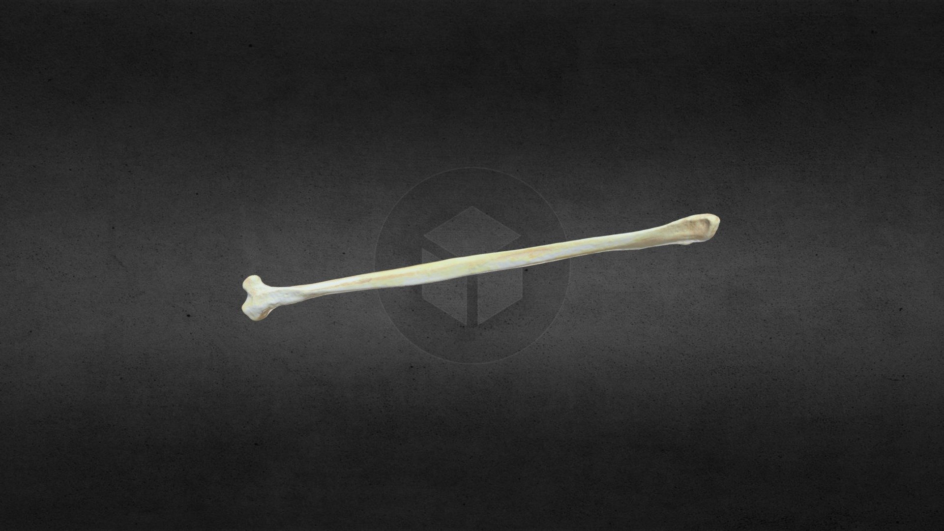 MSCC 007 U Americanus Right Fibula Mesh