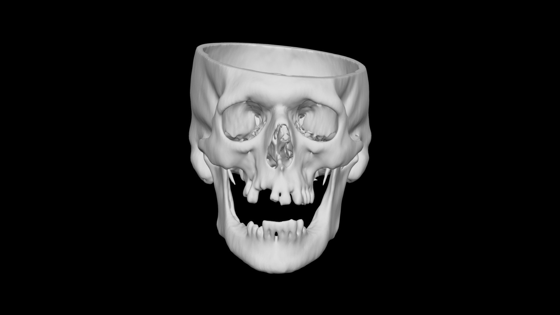 Skull Male 51yo