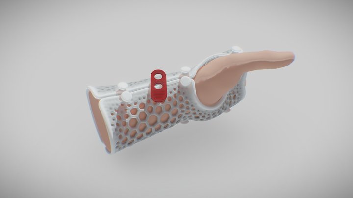 Splint (Férula) 3D Model