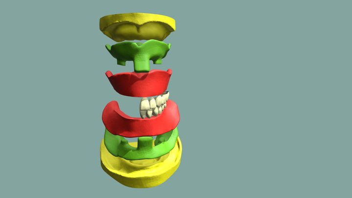 Upper Lower Complete Denture 3D Model