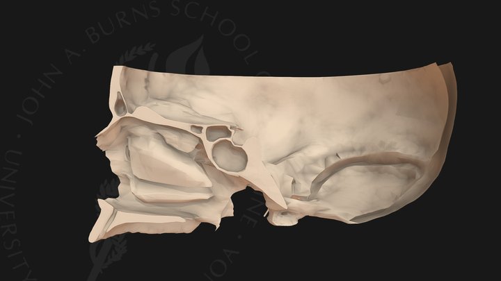 Nasal Cavity 3d Models Sketchfab