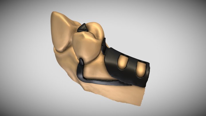 RPI Clasp 3D Model