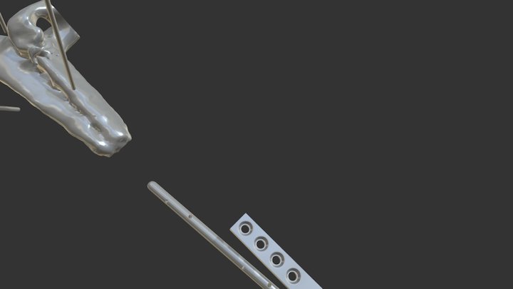 Implant Trenulet [VISUALIZARE] 01 3D Model