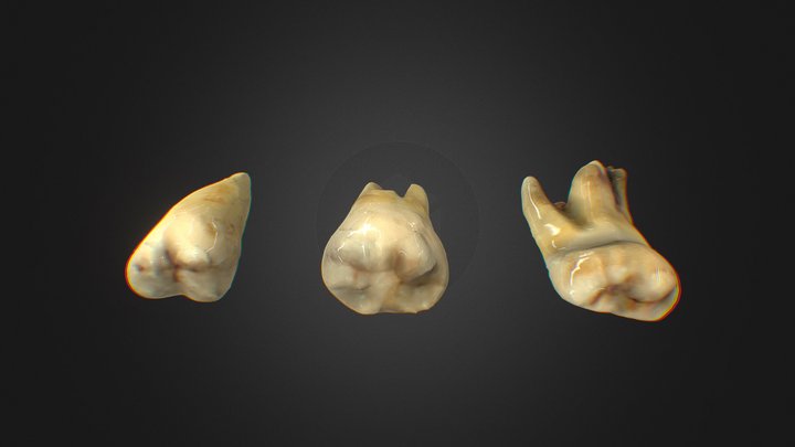 Wisdom Teeth 3D Model