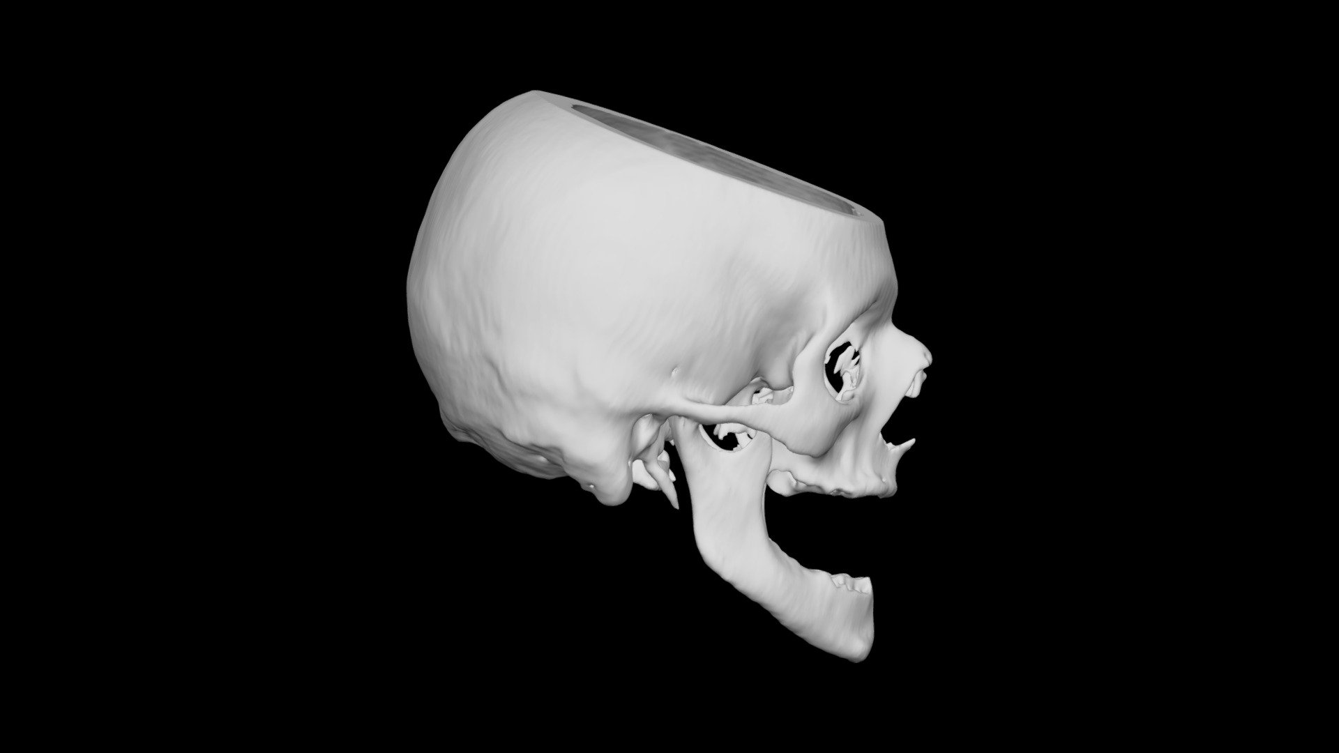 Skull Male 66yo