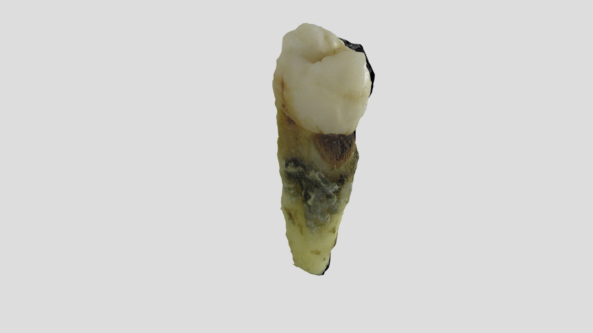 Premolar