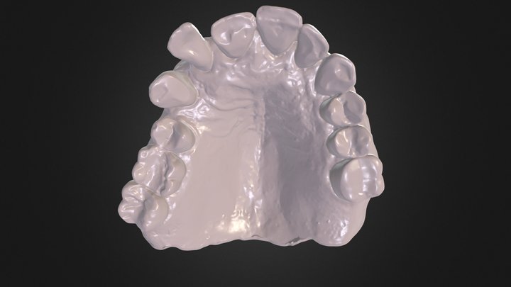 Maxillary Arch Case JJ 3D Model