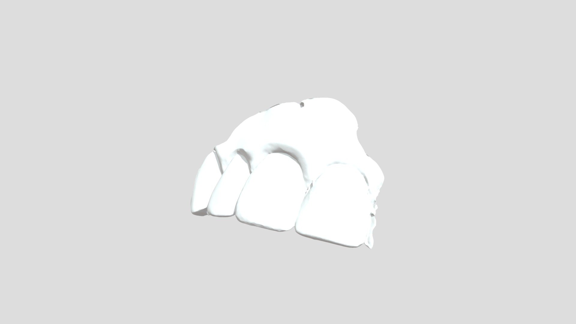 8, Group 4, Dayna T_Upper Jaw - 3D model by UMdental [ee1e677] - Sketchfab