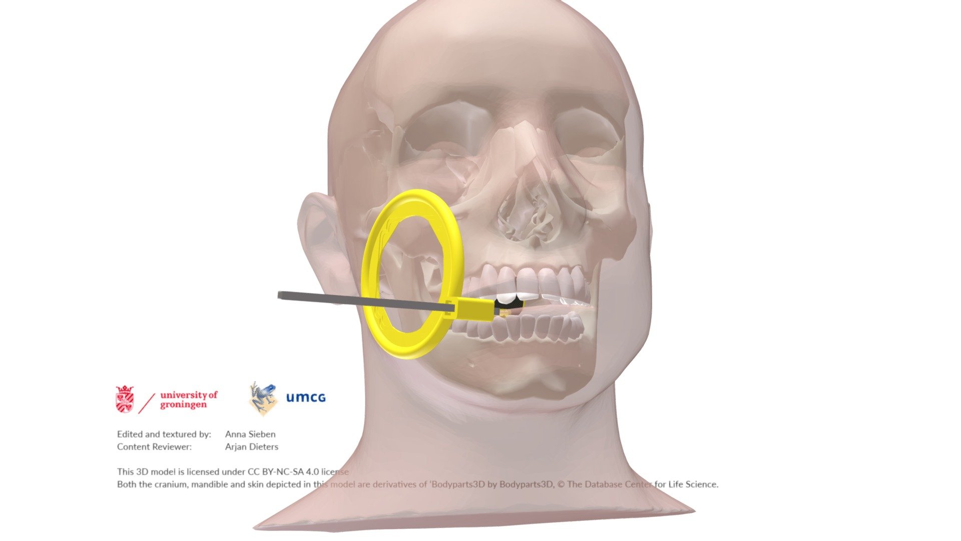 Dental Intra Orl X-ray Positioner, Periapical